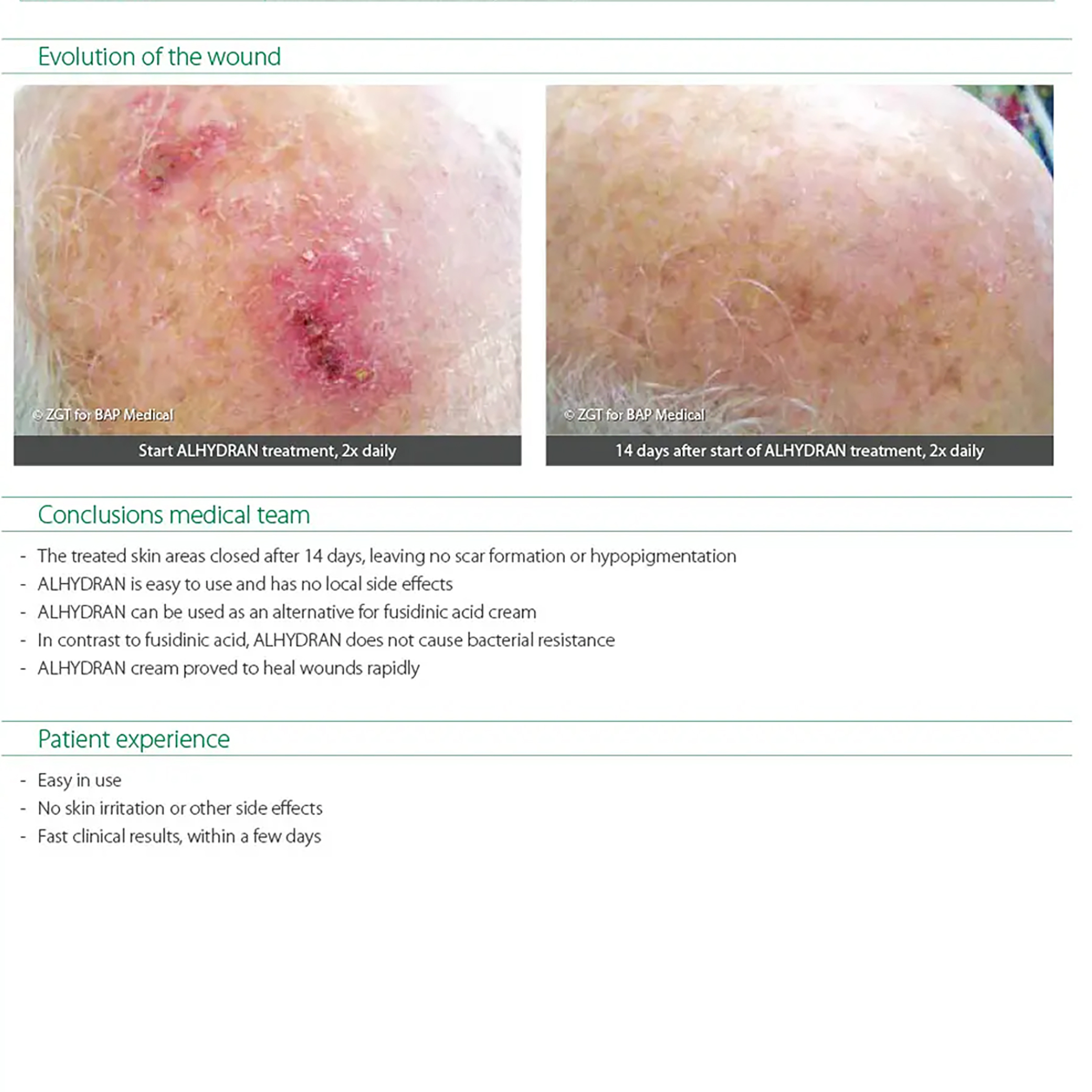 Actinic Keratosis copy