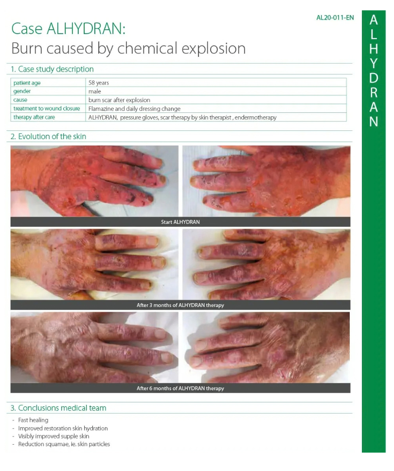Chemical Explosion