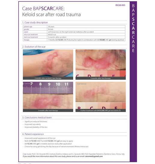 Keloid scar after road trauma