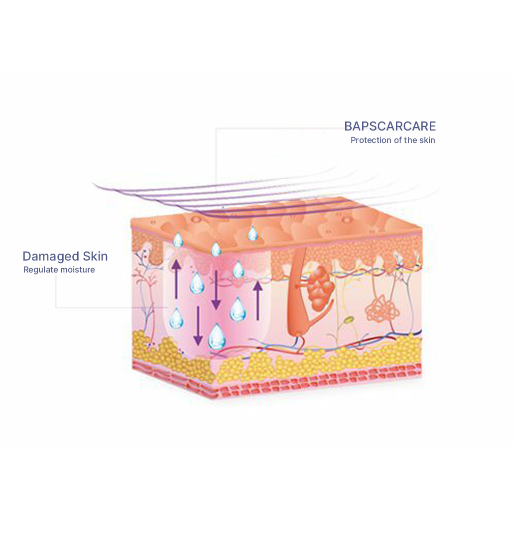 SCAR TREATMENT WITH BAPSCARCARE 2