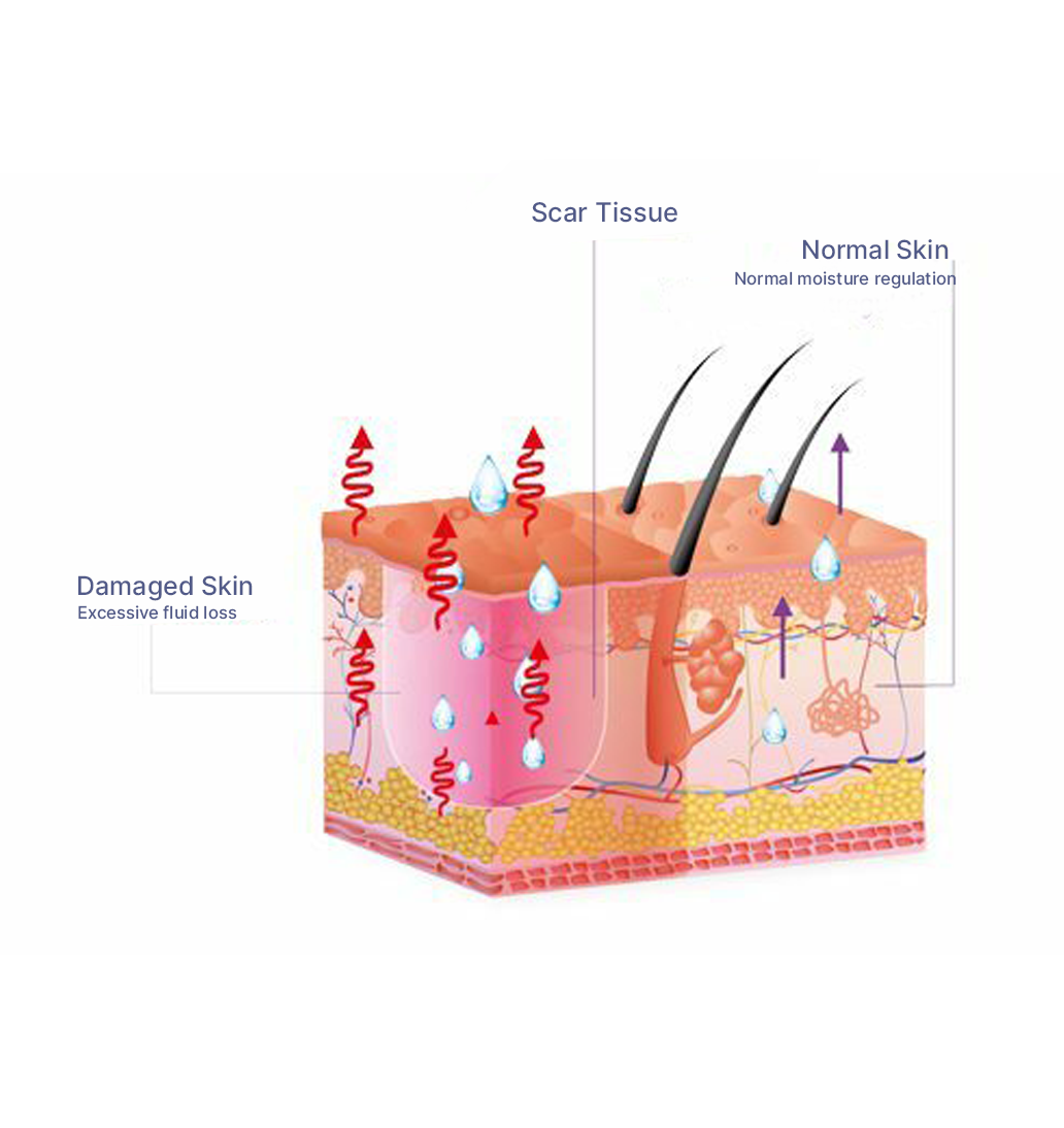 What is scar guide