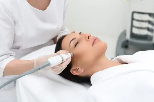 ALHYDRAN laser treatment 02 540x360