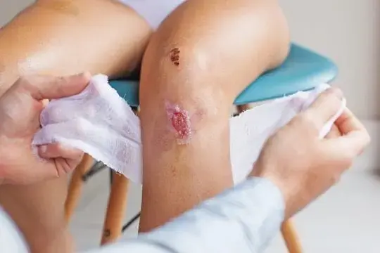 ALHYDRAN wounds 540x360