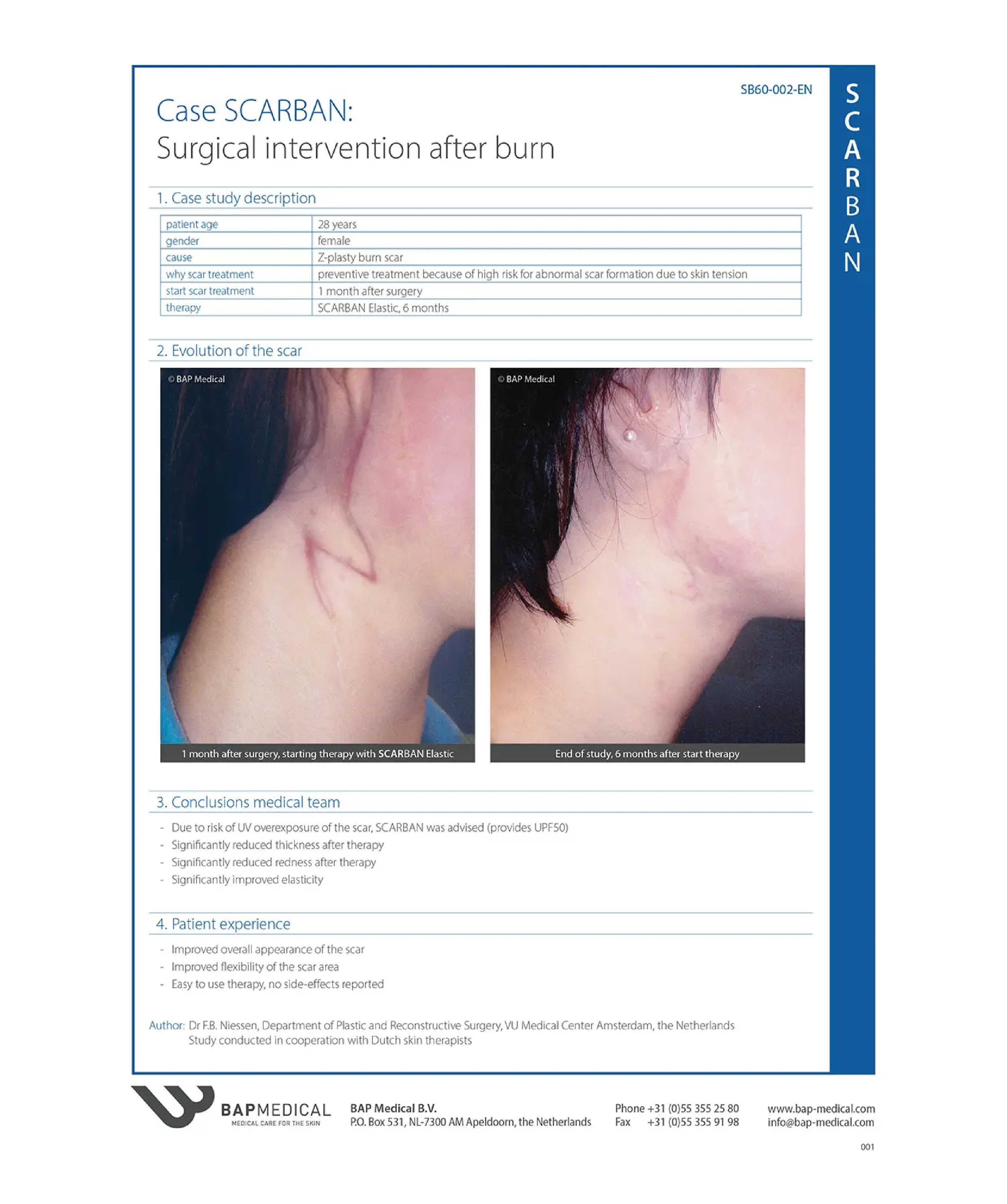 Silicone Sheets after surgical intervention after burn 01
