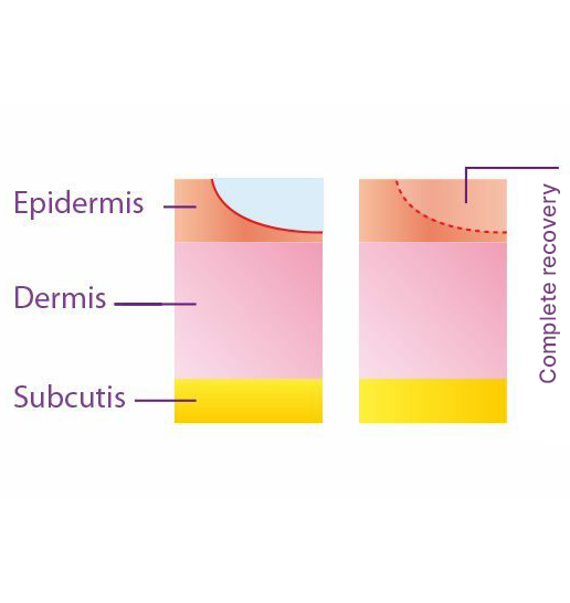 Superficial skin damage